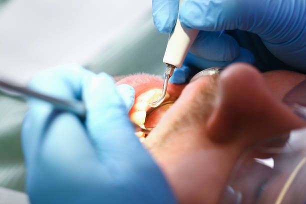 Best Cracked Tooth Emergency Dentist  in Draper, UT